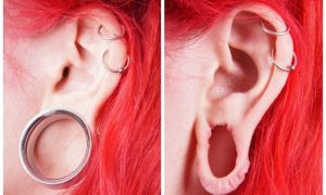 Tunely v uchu